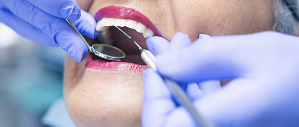 Best Urgent Care for Lost Fillings or Crowns in Tillmans Corner, AL